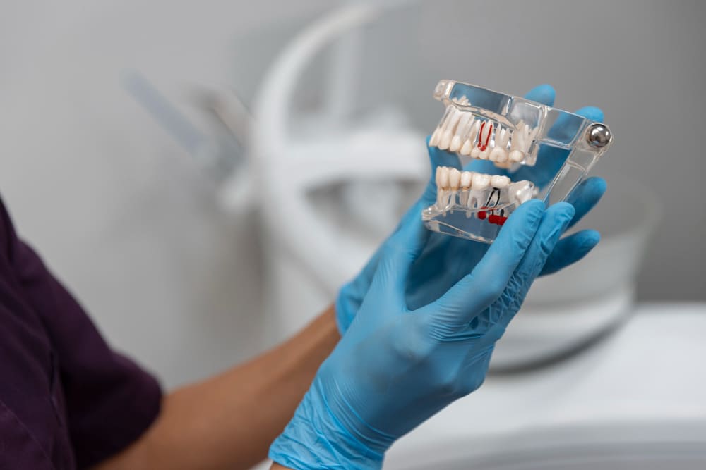 Un implante dental paso a paso